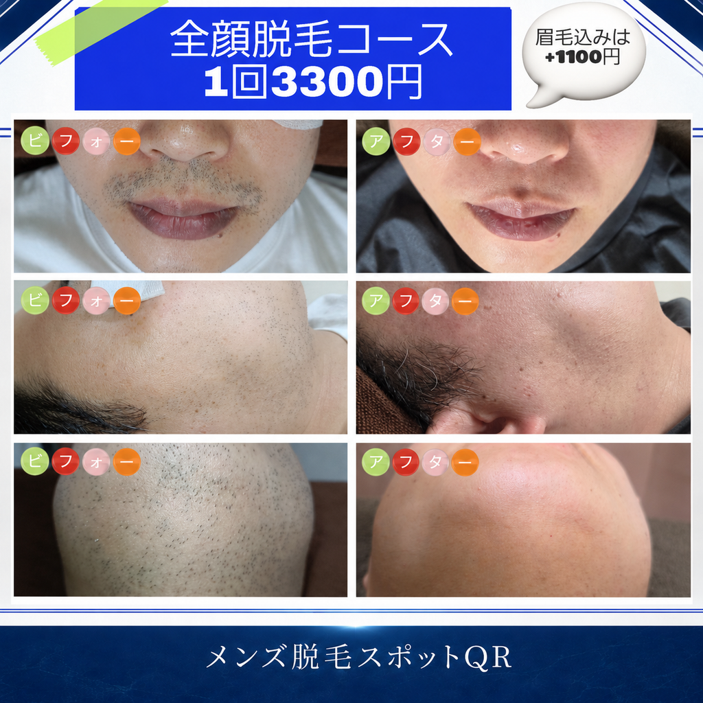 大阪市住吉区のメンズ脱毛スポットQR「全顔脱毛コース」1回3,300円。ヒゲ・頬・あご周りの施術前後を比較したビフォーアフター写真。眉毛脱毛はプラス1,100円。
